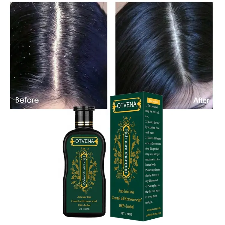 Shampooing anti-chute de cheveux de couleur noire, personnalisé gratuitement de haute qualité avec votre logo corée