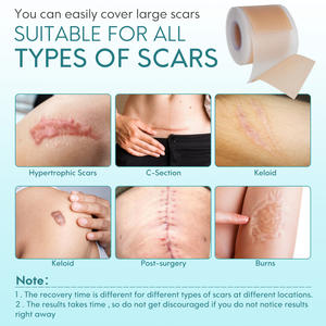 Elaimei Silicon Repair Damage Scar Sheet Gel Venta caliente Eliminación <span class=keywords><strong>de</strong></span> <span class=keywords><strong>cicatrices</strong></span> y marcas Acné Productos <span class=keywords><strong>de</strong></span> eliminación <span class=keywords><strong>de</strong></span> <span class=keywords><strong>cicatrices</strong></span> antiguas - Product Image 4