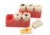 Modelo anatómico de enfermedad de caries dental con resina de aumento 3x modelo de cabeza de ciencia médica de PVC para escuelas entrenamiento de hospitales