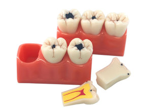 Model penyakit sperma gigi, anatomi gigi dengan perbesaran 3x Resin PVC Model kepala sains medis untuk sekolah rumah sakit pelatihan - Product Image 6