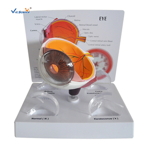 Modelo Médico <span class=keywords><strong>de</strong></span> ojos patológicos <span class=keywords><strong>de</strong></span> Cornea - Product Image 1