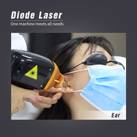 Moonlight Portable 3 Vague 755 808 940 1064 980nm 810nm Épilation Diode Laser 4 Vagues avec AI Chine 4k