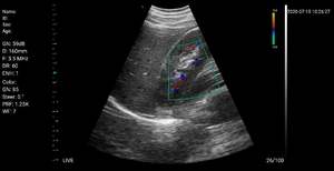 128 éléments portable à ultrasons couleur doppler sonde médicale double-tête 3 en 1 de Beijing Konted - Product Image 6