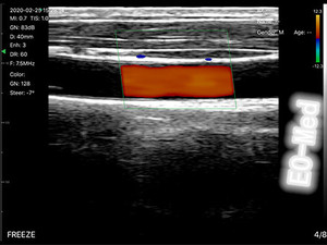 Çift kafa kablosuz ultrason dışbükey/kardiyak/lineer 3 in 1 prob taşınabilir renkli Doppler ultrason Android IOS DCU19E - Product Image 5