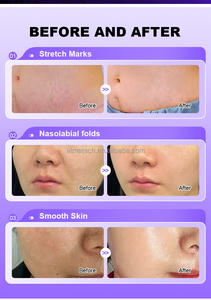 Nouveau Gommage Exfoliant et Rajeunissant pour le Visage et les Yeux 2026 – Idéal pour Salons de Beauté - Product Image 4