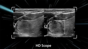 Système d'échographie diagnostique vétérinaire Mindray Vetus 50 pour chats et chiens avec système d'imagerie diagnostique et Doppler couleur - Product Image 6