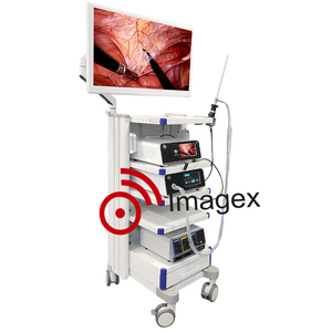 Sistema <span class=keywords><strong>de</strong></span> <span class=keywords><strong>torre</strong></span> <span class=keywords><strong>de</strong></span> imágenes <span class=keywords><strong>de</strong></span> endoscopia 4K UHD <span class=keywords><strong>Torre</strong></span> <span class=keywords><strong>de</strong></span> cámara <span class=keywords><strong>de</strong></span> endoscopia <span class=keywords><strong>de</strong></span> cirugía general completa para hospital - Product Image 6