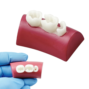 YOUYA DENTAL Dental Training Model for <strong>Tooth</strong> Fillings Resin <strong>Inlay</strong> Model with Three <strong>Teeth</strong> Suitable for Dental Clinics and Schools - Product Image 3