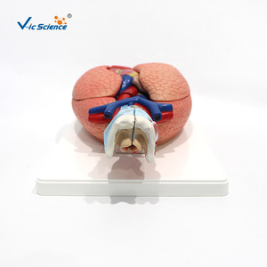 VIC3322 Modèle d'anatomie cardiaque et pulmonaire humaine, modèle du système respiratoire, modèle médical - Product Image 4