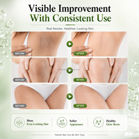 Crème Hydratante Anti-Taches et Anti-Rides à Marque Blanche pour le Visage, Correcteur de Mélasma, Éliminateur de Taches Brunes, En Stock