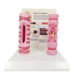 Modè<span class=keywords><strong>le</strong></span> d'asthme KyrenMed : Comparaison entre bronches normales <span class=keywords><strong>et</strong></span> pathologiques avec explications - Product Image 1