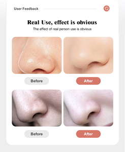 Appareil de nettoyage facial à microbulles pour usage domestique, microdermabrasion, éliminateur de points noirs, nettoyage des pores, mini appareil de nettoyage facial - Product Image 4