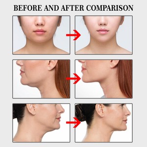 Patch Lifting Viso Jaysuing, Nastro Modellante per Mento a V, Invisibile e Impermeabile per il Trucco - Product Image 6