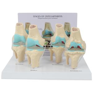 แบบจำลองข้อเข่า 4 ขั้นตอน พร้อมตัวหนีบด้านหลัง แบบจำลองข้อเข่าสำหรับการสอนศัลยกรรมกระดูก ขายตรงจากโรงงาน - Product Image 6