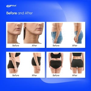 Sistema di Cavitazione a Vuoto UNT Cryo Tech con 4 Manipoli, Macchina per <span class=keywords><strong>Crioterapia</strong></span> 360° per Modellamento del Corpo - Product Image 6