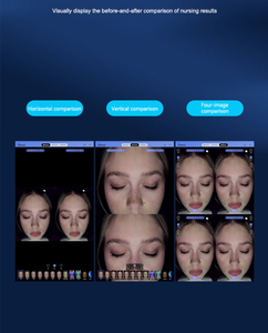 Analyseur facial 3D AI Magic, testeur facial, quatre tons de peau disponibles, analyse 17 problèmes de la peau du visage avec des opérations flexibles - Product Image 3