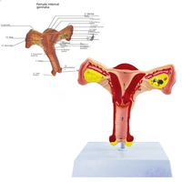 Système reproducteur féminin modèle anatomique utérus et ovaire simulateur d'enseignement gynécologique pour la science médicale