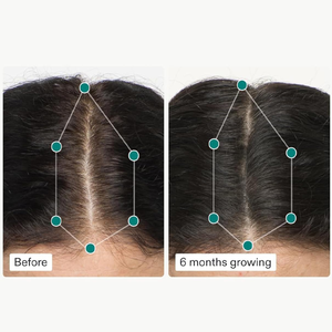 Biotin silikon & Arginine ile LIFEWORTH hormonu içermeyen karmaşık saç sağlık vitaminleri sağlıklı saç cilt ve çivi takviyesini destekler - Product Image 2