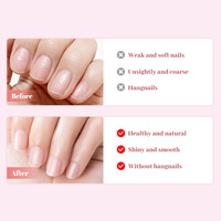 Stylo Huile Fortifiant pour Ongles au Beurre de Karité et à l'Argan : Prévient la Casse, Durcit les Ongles, Répare les Dommages |   Directement de l'usine