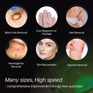 Winkonlaser - <span class=keywords><strong>Precio</strong></span> de la Máquina de Depilación Láser de <span class=keywords><strong>Alejandrita</strong></span> con Láser Nd Yag de Pulso Largo de 755 nm y 1064 nm - Product Image 3