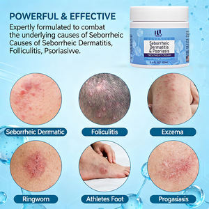 Crème en gros pour la dermatite séborrhéique, soulagement apaisant des démangeaisons et des peaux sèches et squameuses, pour le visage, le corps et le <span class=keywords><strong>cuir</strong></span> <span class=keywords><strong>chevelu</strong></span> - Product Image 2