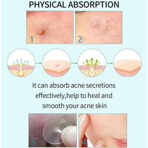 Parche Impermeable Personalizado para el Acné con Aloe Vera, Colágeno y Vitamina C - Hidrocoloide Hidratante para la Curación del Acné Facial - Product Image 6