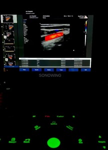 Échographe Doppler <span class=keywords><strong>Panoramique</strong></span> Couleur 2D/<span class=keywords><strong>3D</strong></span> en Temps Réel à <span class=keywords><strong>Prix</strong></span> d'Usine, Appareil Ultrasonore Numérique Complet - Product Image 4