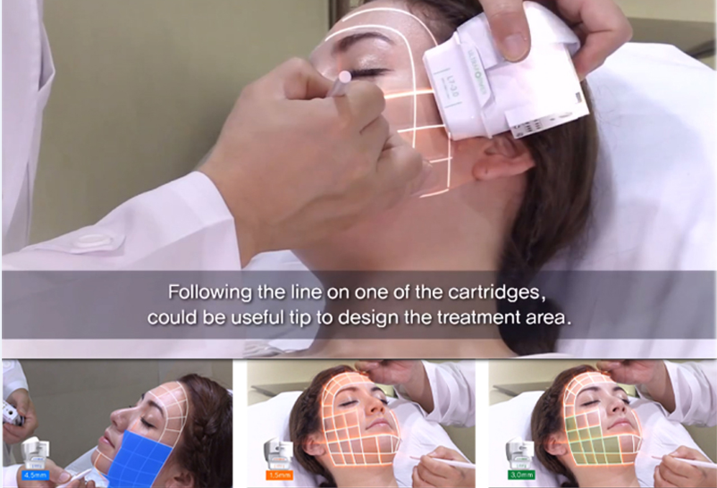 HOT 7d hifu machine / hifu 7d dual handle hifu face lift machine for beauty salon