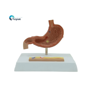Modèle pathologique d'estomac en 2 parties - Démonstration de la transition de la gastrite à la perforation pour l'enseignement en gastroentérologie - Product Image 1