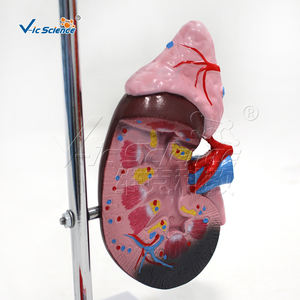 Modelo Anatómico Médico de Patología, Modelo Educativo de Hipertensión, Modelo de Enseñanza de Presión Arterial Alta, Anatomía del Cuerpo Humano - Product Image 6