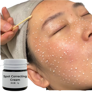 Crema para Eliminar Pecas <span class=keywords><strong>de</strong></span> 50 ml, Cuidado <span class=keywords><strong>de</strong></span> <span class=keywords><strong>la</strong></span> Piel, Eliminador <span class=keywords><strong>de</strong></span> Pigmentación para el Acné y <span class=keywords><strong>Manchas</strong></span> Oscuras <span class=keywords><strong>en</strong></span> el Rostro - Product Image 4