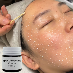 Crema Quita Manchas de Melasma, Elimina Pecas y Manchas Oscuras, Crema para Eliminar Pecas, Eliminador de Pigmentación para el Cuidado de la Piel del <span class=keywords><strong>Rostro</strong></span> - Product Image 3