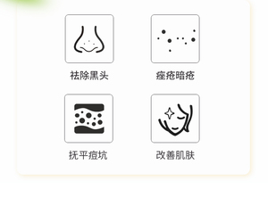 Productos de Belleza 2025, lo Último en Tratamiento Facial para el Acné, Exfoliante, Eliminador de Puntos Negros, Manchas y Verrugas, Equipo de Belleza - Product Image 3