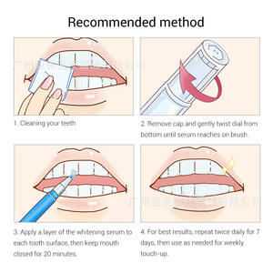 Venta Directa de Fábrica, Plumas de Limpieza Dental de 2 ml Fáciles de Transportar, Herramientas Giratorias para Blanquear los Dientes para Uso Doméstico - Product Image 4