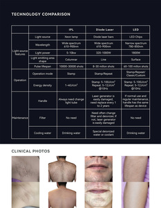 2025 Leaflife Medical CE 510k Professional <strong>Laser</strong> <strong>Hair</strong> <strong>Removal</strong> / Permanent Painless LED <strong>Laser</strong> <strong>Hair</strong> <strong>Removal</strong> Machine Professional - Product Image 5