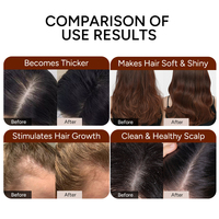 Kit de croissance capillaire botanique personnalisé à marque distributeur : Shampoing et après-shampoing à l'argan et au romarin, traitement nourrissant du cuir chevelu, formule nourrissante, fournisseur exportateur