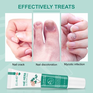 Pomada reparadora nutritiva antiinfección <span class=keywords><strong>de</strong></span> uñas <span class=keywords><strong>de</strong></span> los pies, crema reparadora <span class=keywords><strong>de</strong></span> hierbas antihongos, OEM - Product Image 3