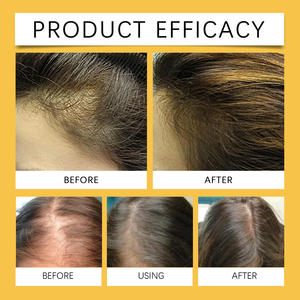 Huile capillaire nourrissante qui nourrit et renforce en profondeur les mèches de cheveux, soulage le cuir chevelu sec pour des cheveux épais et luxuriants, huile de soin capillaire - Product Image 3