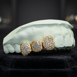 Grillz dentaire Hip Hop en argent 925 plaqué or rose personnalisé avec moissanite, motif nid d'abeille, certifié par un tiers, pour hommes et femmes - Product Image 1
