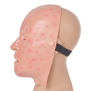 Máscara de Demostración de Lesión Facial por Viruela Leve - Product Image 3