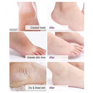 มาส์กลอกเท้า3แพ็คมาลาเวนเดอร์ผสมของเหลวสูตรสำหรับส้นเท้าแตกผิวตาย & แคลลัสเด็กทารกผิวนุ่มเรียบเนียน - Product Image 3