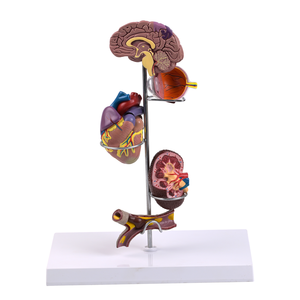 Modelo Anatómico <span class=keywords><strong>de</strong></span> 5 Partes <span class=keywords><strong>de</strong></span> los Órganos del Cerebro, Corazón, Ojo, Riñón y Vasos Sanguíneos, Producto <span class=keywords><strong>de</strong></span> Ciencia Médica para <span class=keywords><strong>el</strong></span> Estudio <span class=keywords><strong>de</strong></span> la Hipertensión - Product Image 3