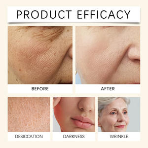 <span class=keywords><strong>Crème</strong></span> au miel qui adoucit, hydrate, repulpe, rafraîchit, resserre les pores pour le <span class=keywords><strong>visage</strong></span> - Baume au miel pour tous types de peau - Product Image 4