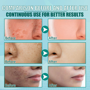 Crème éclaircissante et anti-taches avec propriétés hydratantes et anti-rides, crème raffermissante pour le soin de la peau, 20g - Product Image 3