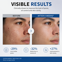 Sérum Visage Hydratant Essentiel pour Hommes OEM 30ml – Équilibre Hydrique, Acide Hyaluronique et Acide Azélaïque – Soin Visage Peaux Sèches
