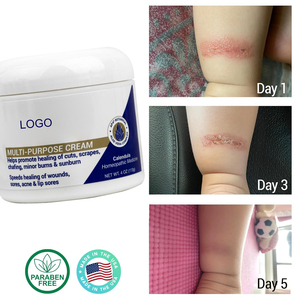 Crema Multiusos de Marca Privada que <span class=keywords><strong>Ayuda</strong></span> <span class=keywords><strong>a</strong></span> Promover la Curación de Cortes, Rasguños, Rozaduras, Quemaduras Menores y Quemaduras Solares - Product Image 3