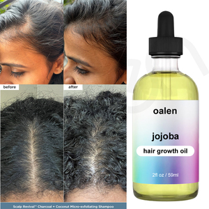 Olio di Jojoba Premium 59ml per la Crescita dei <span class=keywords><strong>Capelli</strong></span>, 100% Puro e Naturale, Stimola i Follicoli, Riduce la <span class=keywords><strong>Caduta</strong></span> dei <span class=keywords><strong>Capelli</strong></span>, Marchio Privato - Product Image 2