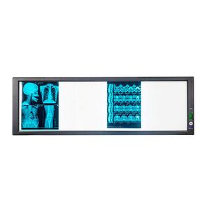 Visionneuse de films radiologiques LED électrique portable avec certification CB pour la radiographie hospitalière - Product Image 3