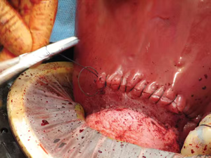 Simulatore Premium per Emorragie Post-Parto (PPH) |   Modello di Addestramento per Emostasi in Emergenze Ostetriche - Product Image 3