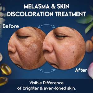 Bosman OEM Aloe Vera kem cho nám điều trị tuổi tại chỗ Remover da đổi màu sau tì vết vết sẹo điểm mặt cơ thể - Product Image 3